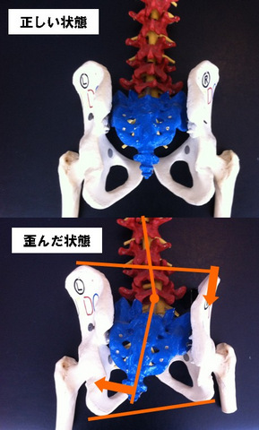 骨盤モデルによる説明